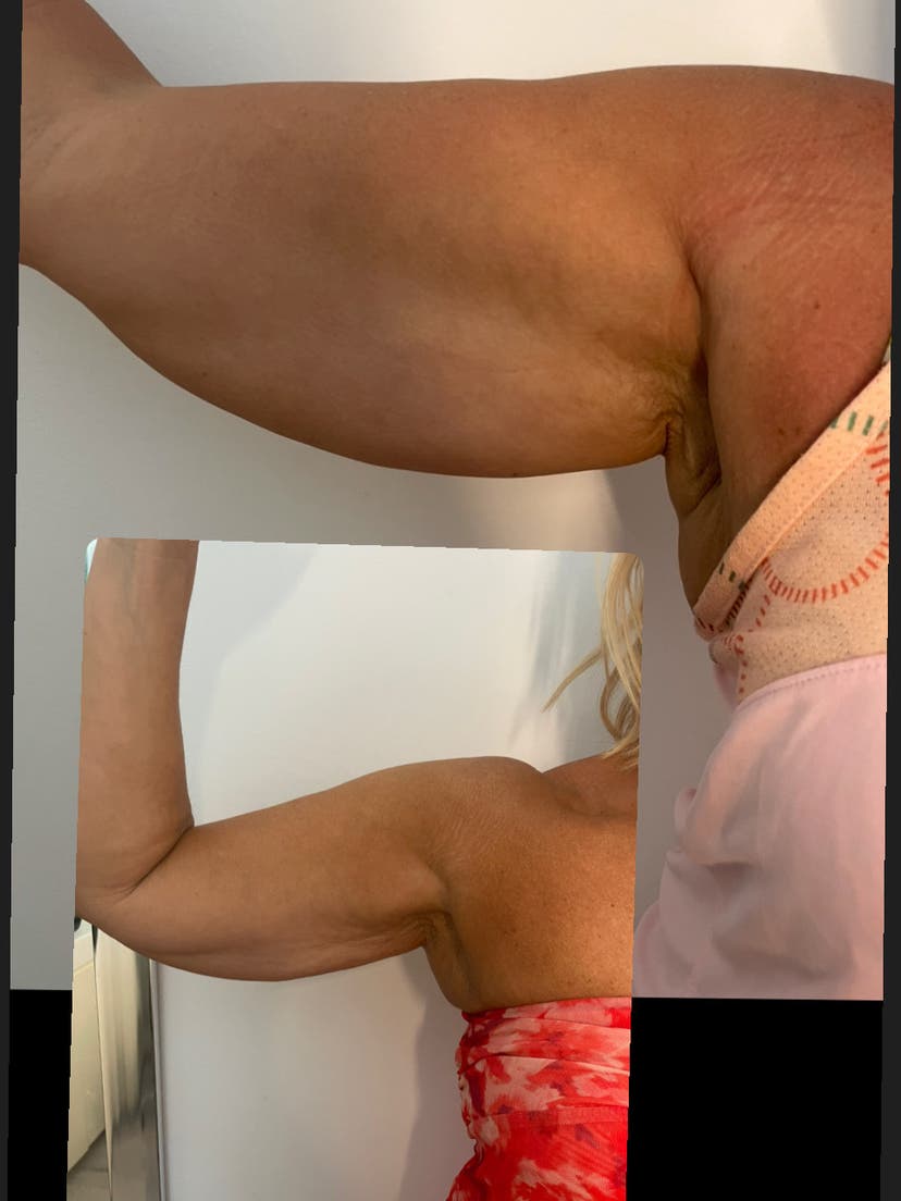 Muscular arm flexed showcasing defined biceps in a modern salon interior in Mijas-Costa, Andalucía, ES.